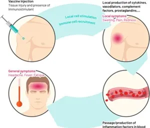 immune response