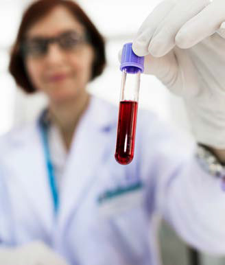 Liquid Biopsy
