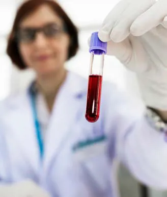 Liquid Biopsy