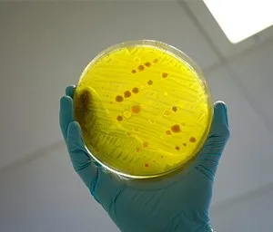 Antimicrobial Resistance