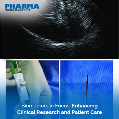 Biomarkers in clinical research