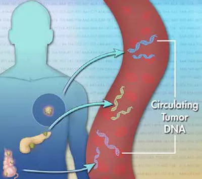 Gene Therapy for Cancer