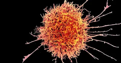 cancer cells