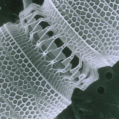 nanotechnology in drug delivery systems