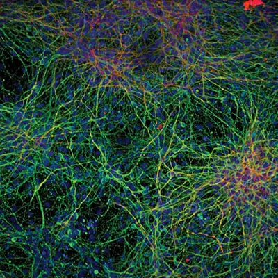 neurological disorders