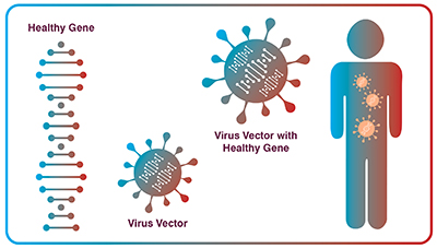 Viral Gene Therapy 