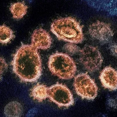 Virus-Like Particle Vaccines