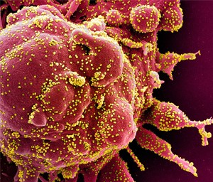  Virus-Like Particles (VLPs)