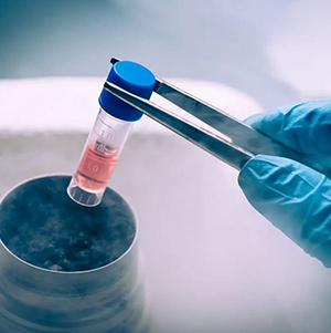 Stem Cell Therapy for Autoimmune Diseases