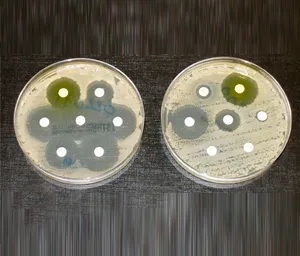 Global antibiotic crisis