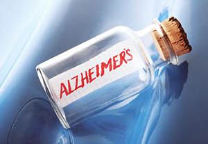 Alzheimer's drug trial results amyloid plaques