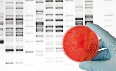 Microbiome and Microbial 