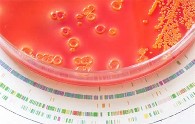 Microbiome and Microbial 