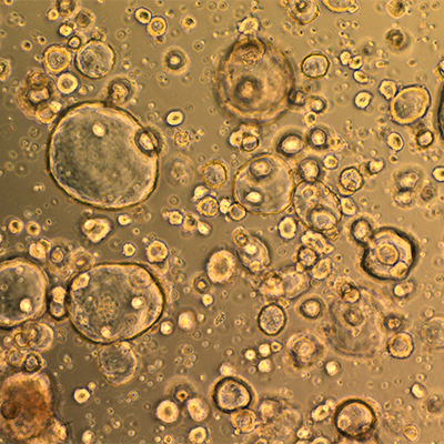 3D organoid cultures under a microscope
