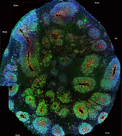 Microscopic view of a human brain organoid showing intricate neural structures