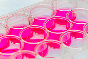 Tissue Engineering and Stem Cell Therapy